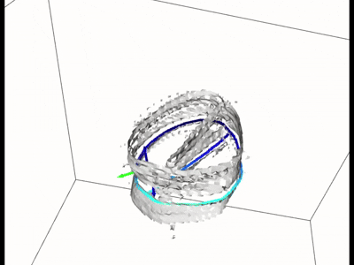 aortafast.gif